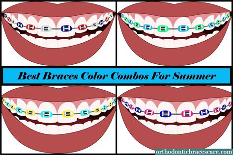 Braces Color Combinations