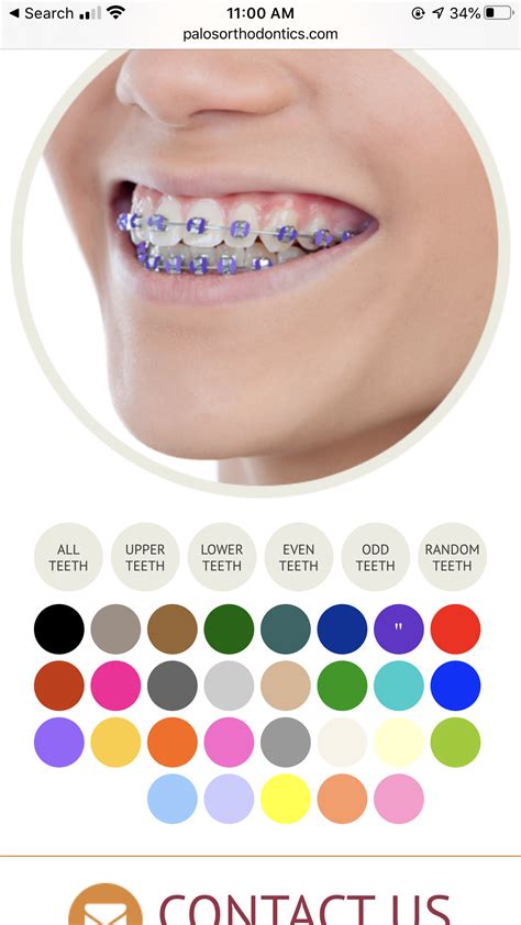 Braces Colors