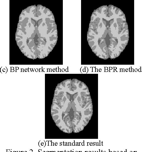 Pattern Recognition Method